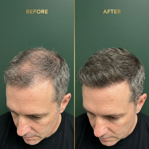 STAGROOT Rosemary + Biotin Hair Oil for Thinning Hair